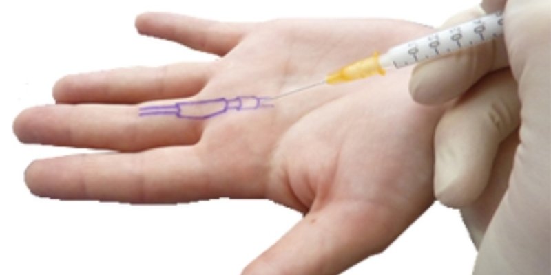 AES 325 Steroid Shot & PR