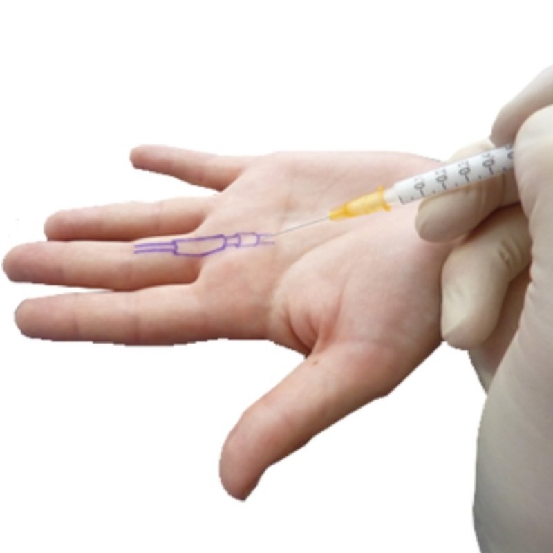 AES 325 Steroid Shot & PR