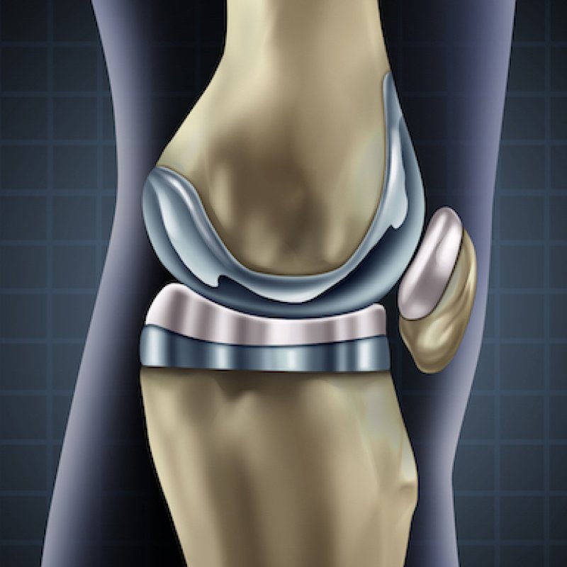 AES 980 Bionic Woman