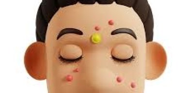 AES073 Stiker Jerawat